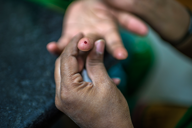 Diabetes: Why Awareness is Key to Preventing Serious Complications